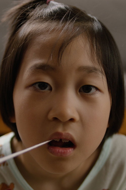 Milk tooth